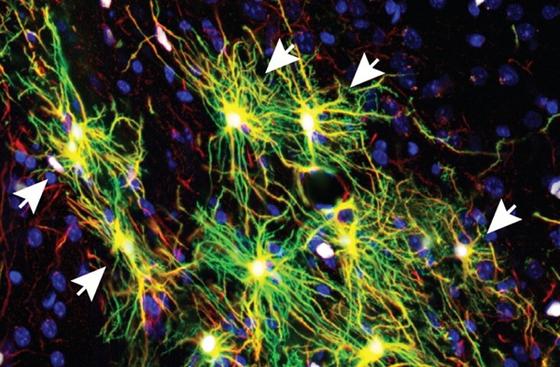 Die komplexe Struktur der menschlichen Astrozyten entwickelt sich auch in den Mäusegehirnen.