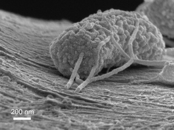 100 dieser Mikroben bilden die Größe eines menschlichen Haares.
