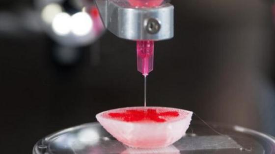 Ein 3D-Drucker stellt Knorpelgewebe her. US-Forschern ist es jetzt gelungen, mit ein und demselben Gerät verschiedene Organe wie Niere, Herz oder Lunge in nur 30 Minuten herzustellen. 