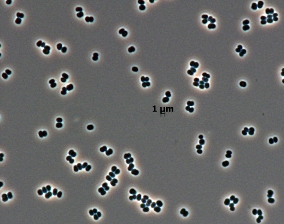 Die mikroskopische Aufnahme zeigt Dutzende von individuellen Bakterienzellen des kürzlich entdeckten Tersicoccus phoenicis.
