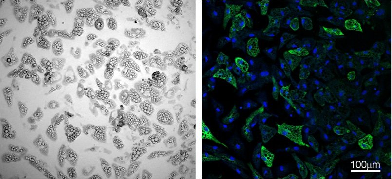 Schlankmacherfett: Braune Fettzellen, hier fluoreszierend, geben verstärkt Energie in Form von Wärme ab.