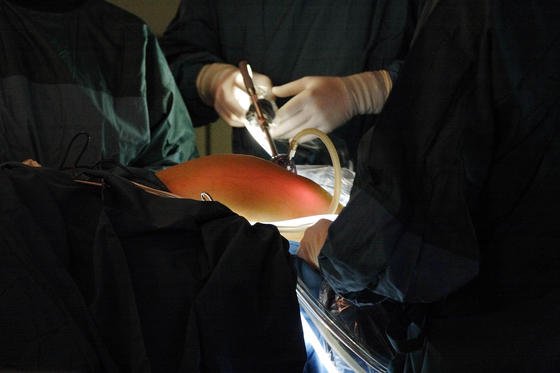 Operation mit dem Endoskop: Fraunhofer-Forscher haben hydraulische OP-Werkzeuge entwickelt, in denen die bisher üblichen Seilzüge durch eine sterile, für den Menschen unschädliche Flüssigkeit ersetzt wurden. Damit lässt es sich präziser arbeiten. 