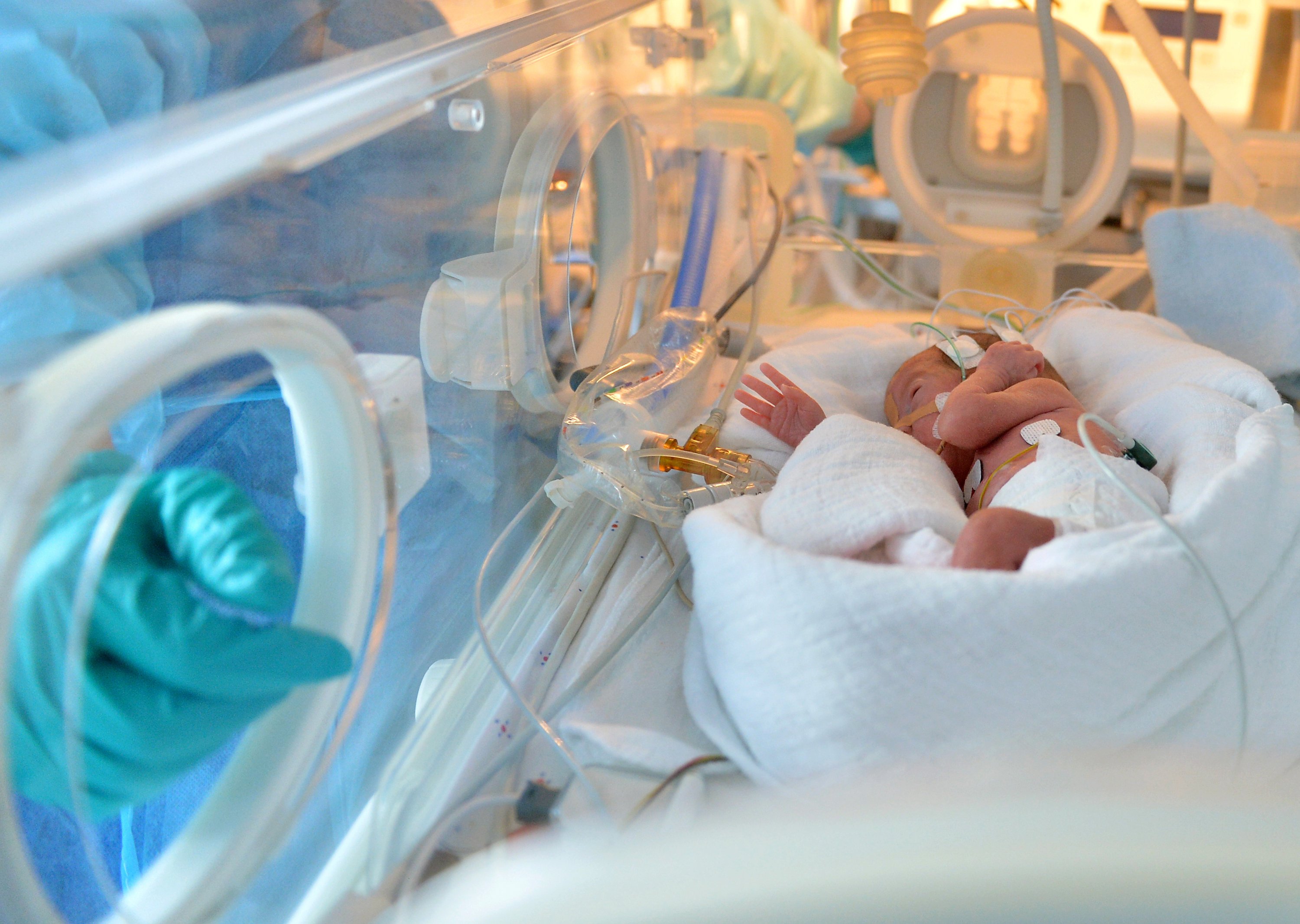 Ein zu früh geborenes Baby liegt in einem Inkubator. Solche Geräte sind sperrig und schwer zu transportieren. Der Brutkasten des 23-jährigen Briten lässt sich hingegen auf die Größe eines Aktenkoffers zusammenklappen.