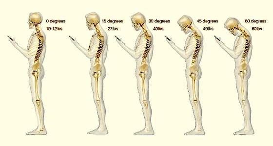 Nicht auf Augenhöhe: Smartphone-Nutzer schauen meist mit gesenktem Kopf auf das Display. Das belastet – je größer die Neigung des Kopfes, desto mehr Gewichtdrückt auf den Nacken. 