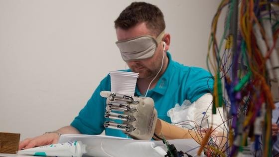 Ein Patient übt den Umgang mit der Prothese LifeHand 2 der Universität Freiburg. Sensoren empfangen Impulse aus seinem Nervensystem, die die Prothese in Bewegungen umsetzt. Damit diese genau richtig dosiert sind, messen Sensoren den Druck und übertragen ihn zurück ans Nervensystem. 