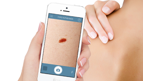 Mit dem Smartphone können Kunden Fotos von Hautproblemen an Goderma schicken. Innerhalb von 48 Stunden meldet sich ein Hautarzt mit einer Einschätzung. Diese Telemedizin ist medizinisches und juristisches Neuland. 