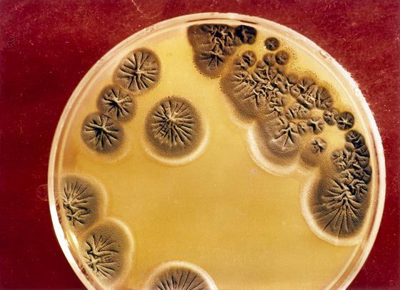 Pilzkultur in einer Petri-Schale: Infektionskrankheiten werden mächtiger, wenn die Bakterien gegen Antibiotika Resistenzen bilden. Forscher suchen deswegen nach neuen Wirkstoffen im Erdreich – und haben Teixobactin gefunden. 