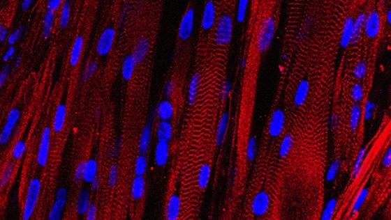 Im Labor gewachsene menschliche Muskeln: Unter dem Mikroskop zeigt die rote Färbung die typischen Streifen der Muskelfasern.