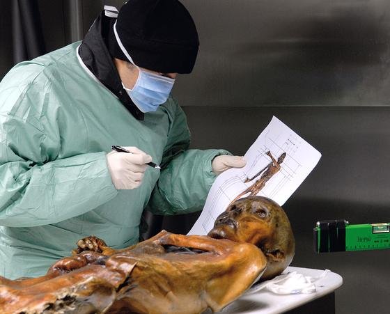 Ötzi im Labor: Die Forscher des EURAC-Instituts für Mumien und den Iceman haben auf der Brust der Mumie ein weiteres Tattoo entdeckt.
