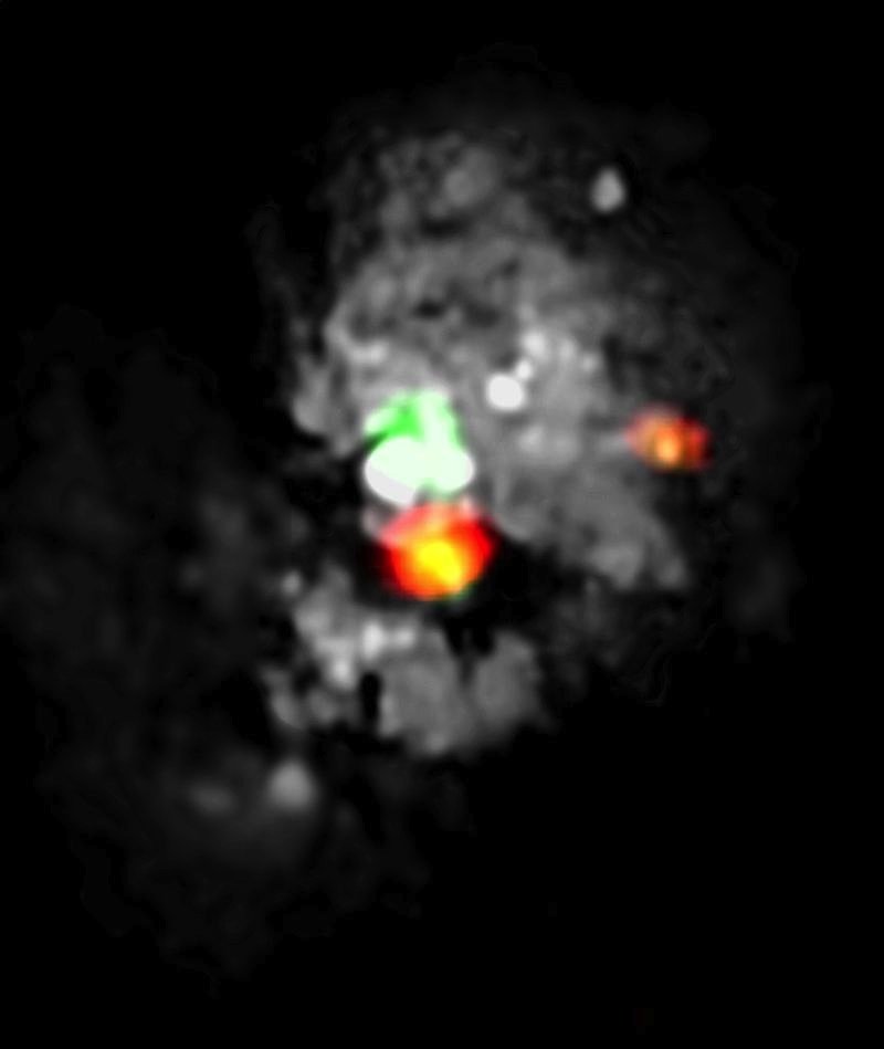 Blick ins Unbekannte: Mit dem Noema-Observatorium haben Wissenschaftler eine bisher unerforschte Region massiver Sternentstehung im Medusa Merger (NGC 4194) ausfindig gemacht. Das Bild, das Beobachtungen mit Noema und dem Hubble Space Teleskop beinhaltet, zeigt das „Auge der Medusa“ (orange), das sich direkt unterhalb des Zentrums von NGC 4194 befindet (hier weiß und grün), einem Paar kollidierender Galaxien.