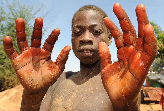 Ein Kind zeigt seine Hände in der Goldmine Poushgin in Zorgho in Burkina Faso. Mit Henna versuchen die Kinder die Haut zu schützen, die durch das Arbeiten mit Quecksilber stark in Mitleidenschaft gezogen werden. 