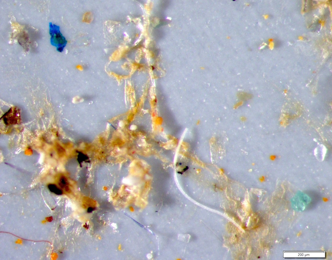 So sieht Mikroplastik aus einer Kläranlage unter dem Mikroskop aus: Die Kunststofffasern waschen sich beispielsweise aus Textilien aus. Auch Kunststoff aus Kosmetika landen im Wasser.