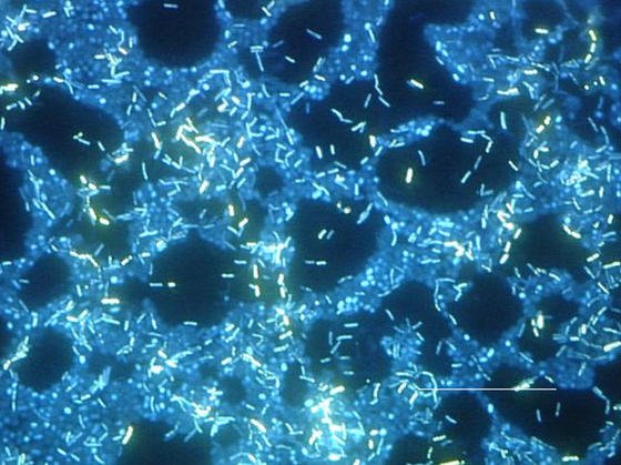 Fluoreszenz-mikroskopische Aufnahme eines Biofilms auf rostfreiem Stahl.
