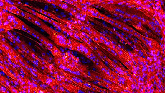 Der Natur nachgeahmt: Ein Geflecht aus Muskelfasern wächst auf einem Gerüst auf gesponnenem Kunststoff. Unter dem konfokalen Laser-Scanning-Mikroskop erscheinen Muskelfasern rot und Zellkerne blau.