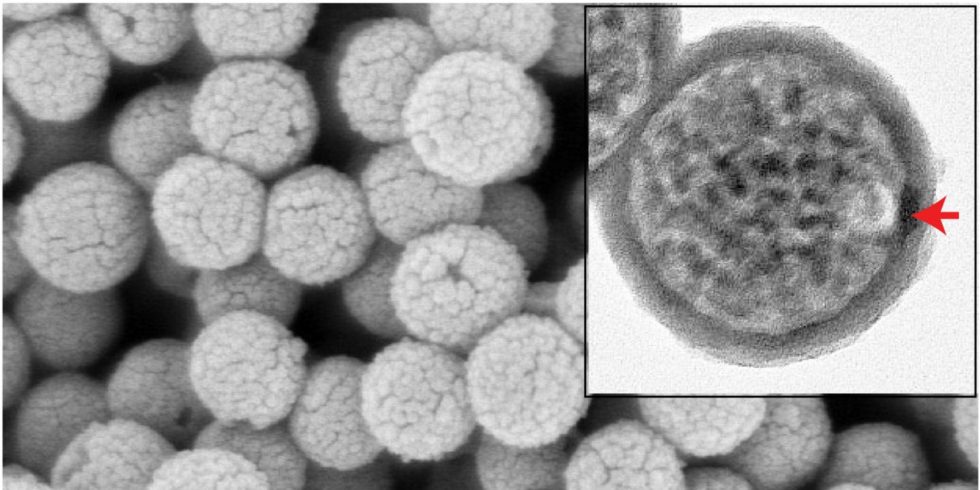 Nanokapseln im Rasterelektronenmikroskop. Über die Öffnung (Pfeil) gelangen Wirkstoffe nach außen. 
Foto: Jichuan Qiu / Georgia Institute of Technology 