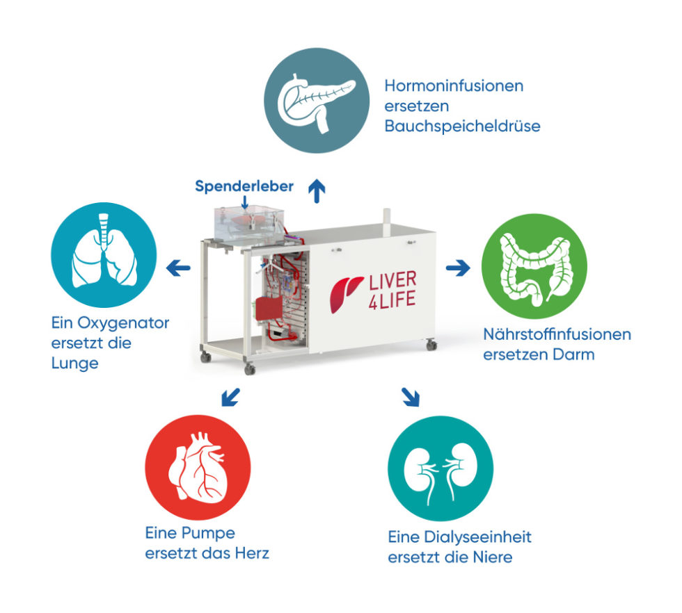 Schema Perfusionsmaschine