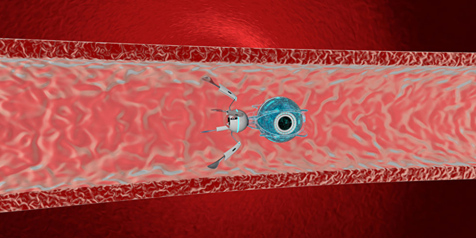 Nanoroboter