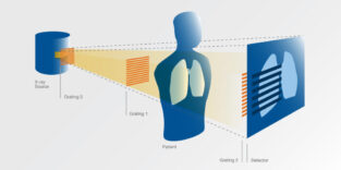Aufbau des Dunkelfeld-Röntgenverfahrens