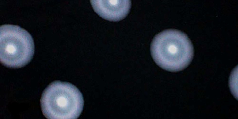 Kolonien von Legionella pneumophila Serogruppe 1 auf Agar. Foto:Dr. habil. Anna Salek