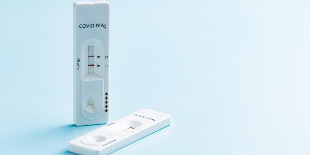 Sicherer und schneller: Tuning für medizinische Schnelltests