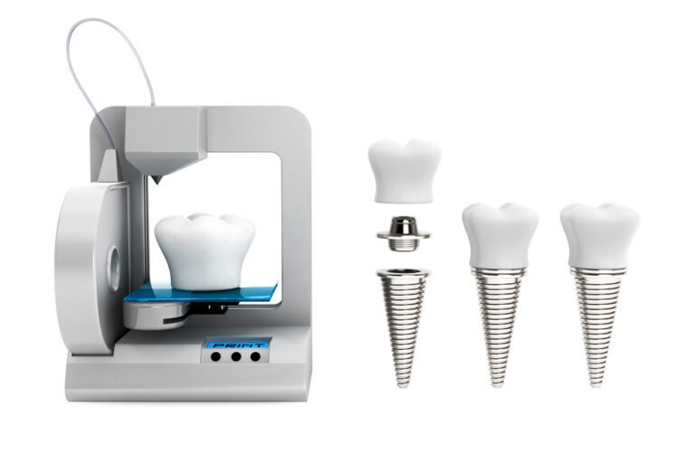 Zahnprothesen 3D-Druck