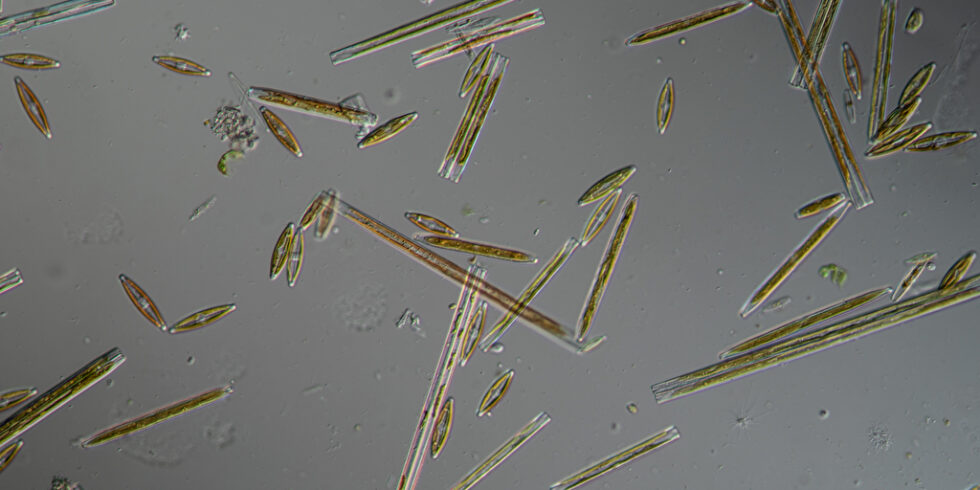 Mikroalgen unter Mikroskop