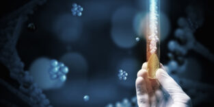 Enzyme Biotechnologie