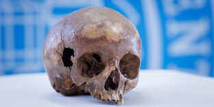 Schädel aus dem Oktogon von Ephesos