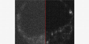 Bild eines lebenden Mausembryos mit und ohne optimierte Aufnahme durch eine Quantenkamera