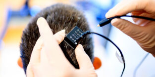 Forscher verbinden Anns Hirnimplantat mit dem Sprachsynthesizer-Computer