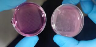 3D-gedruckte Struktur mit menschlichen Keratinozyten