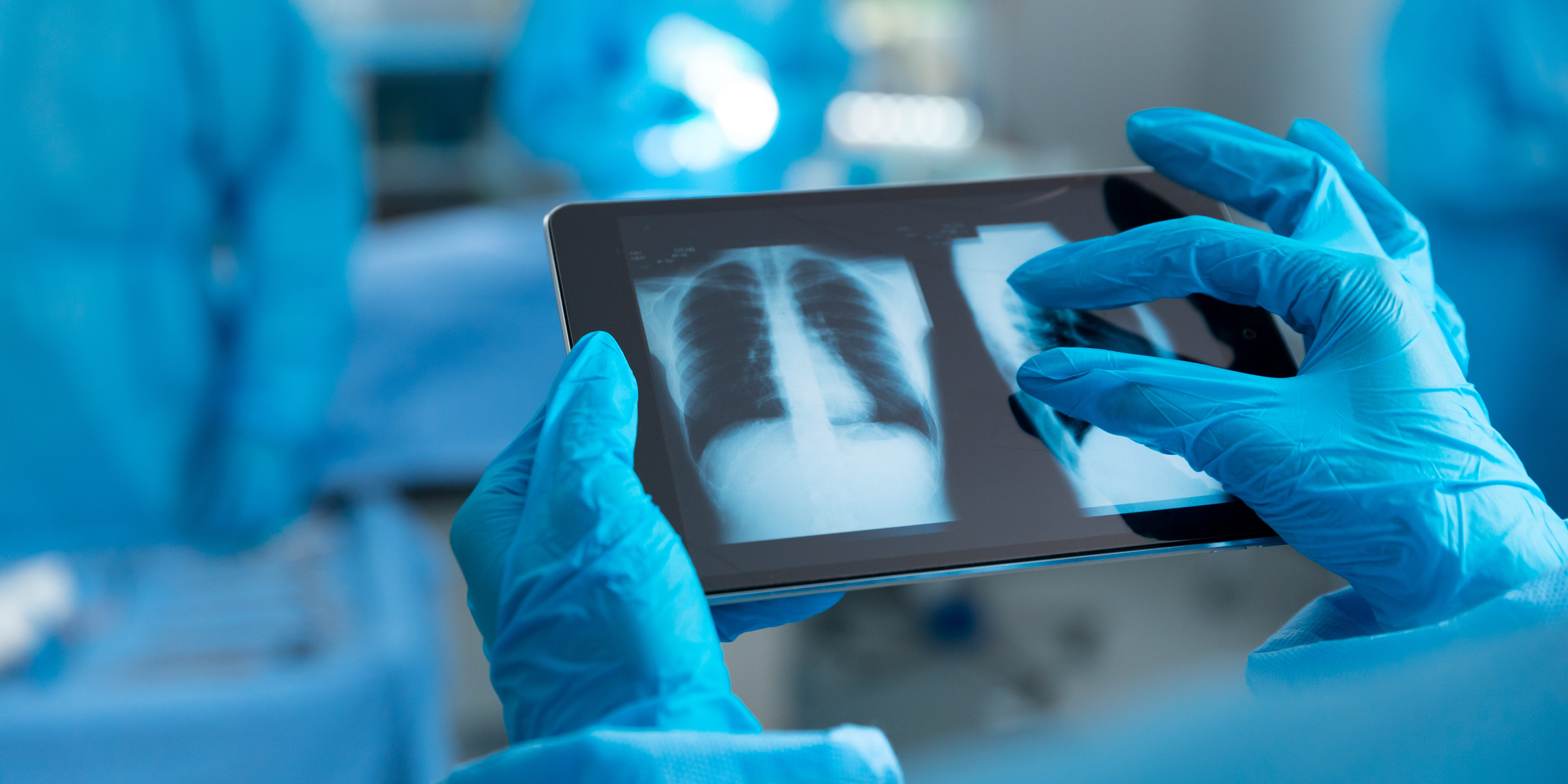 COVID-19: Diese Immunzellen entscheiden über Leben und Tod