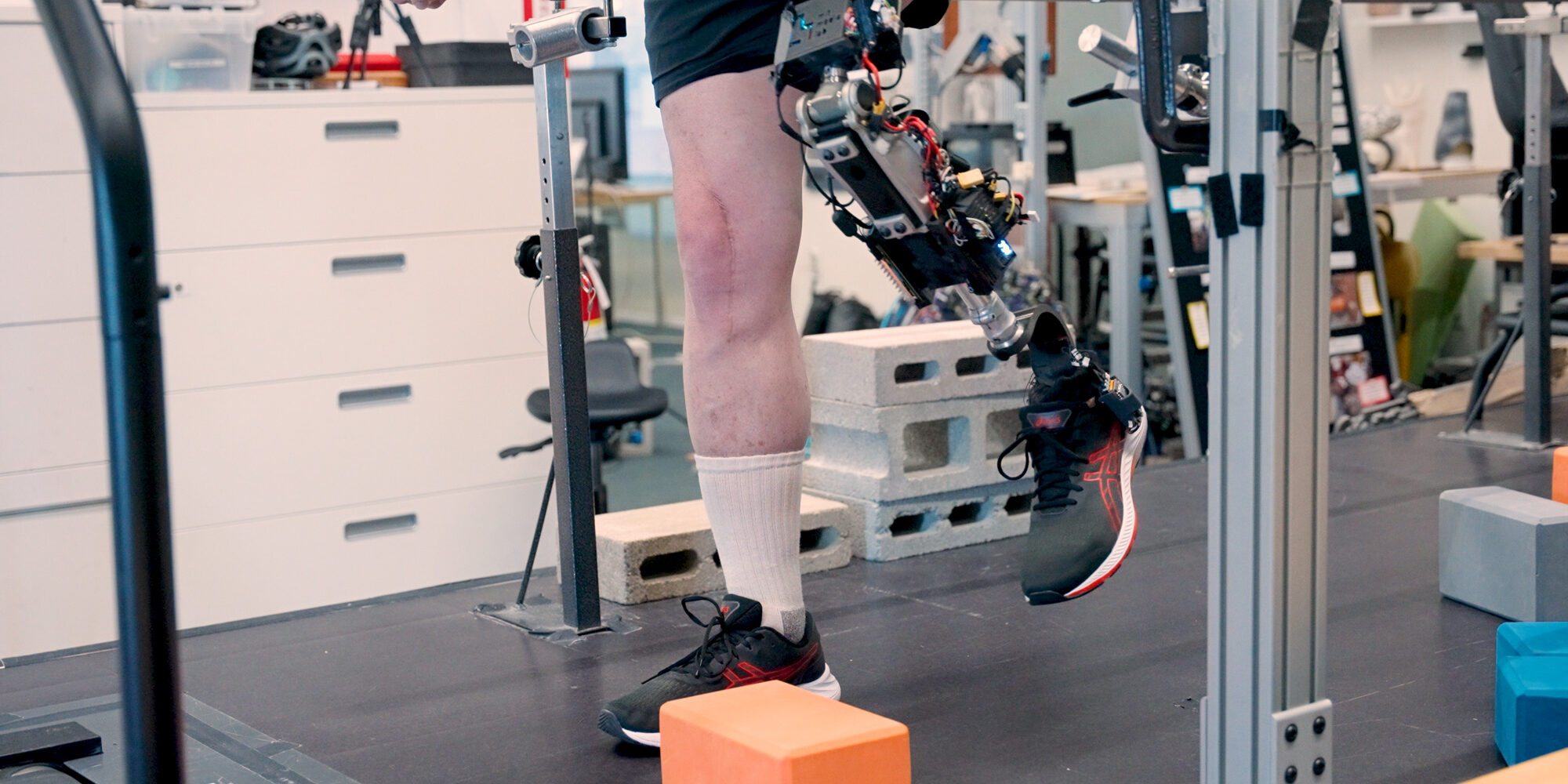 Künstliches Knie mit Nervenkontakt – Gehen wie vor der Amputation?