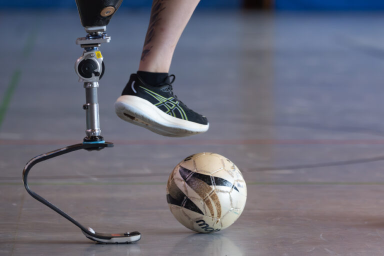 Fußball spielen mit Prothese