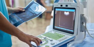 Medizinisches Personal steht vor einem tragbaren Ultraschallgerät.