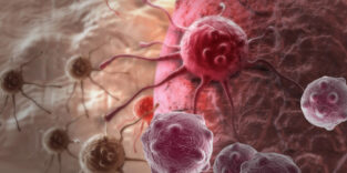 Grafische Darstellung von Krebszellen