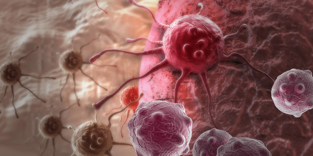 Grafische Darstellung von Krebszellen