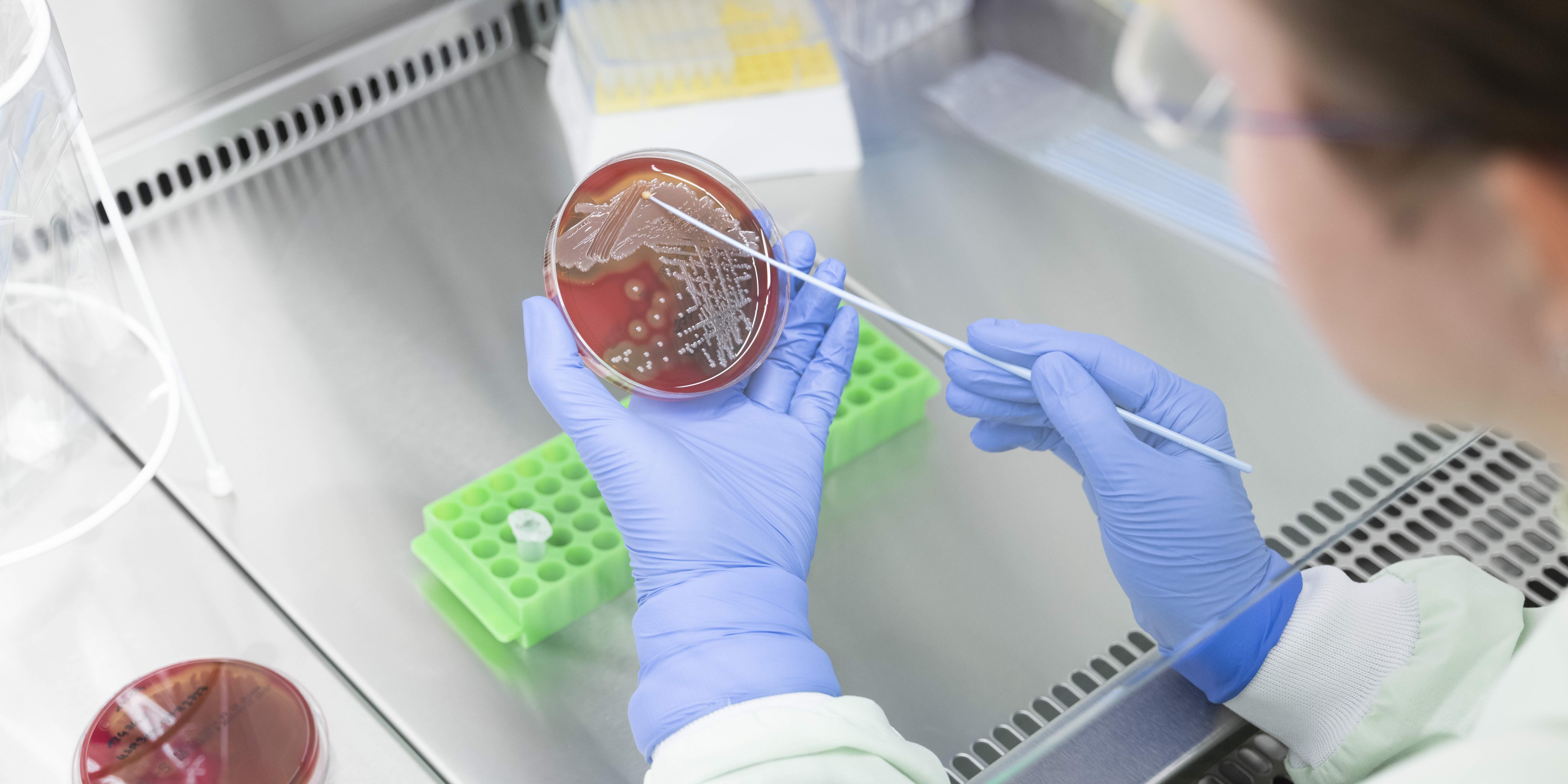 Mini-Chip aus Jena beschleunigt Test auf Antibiotikaresistenz