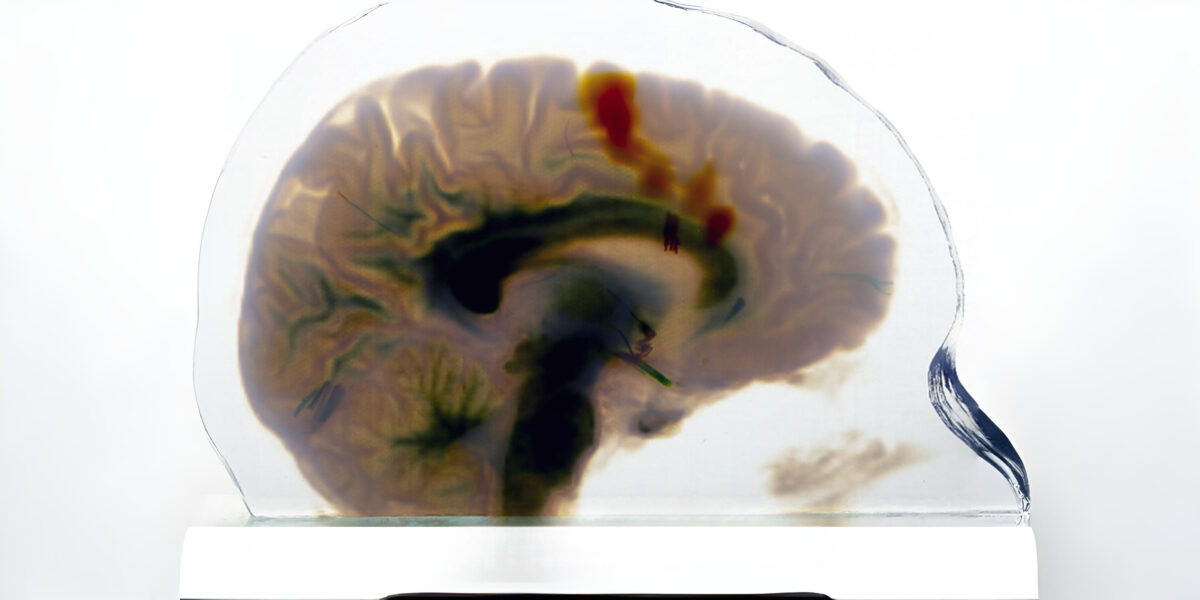 Ein medizinisches Scan-to-Print-Modell