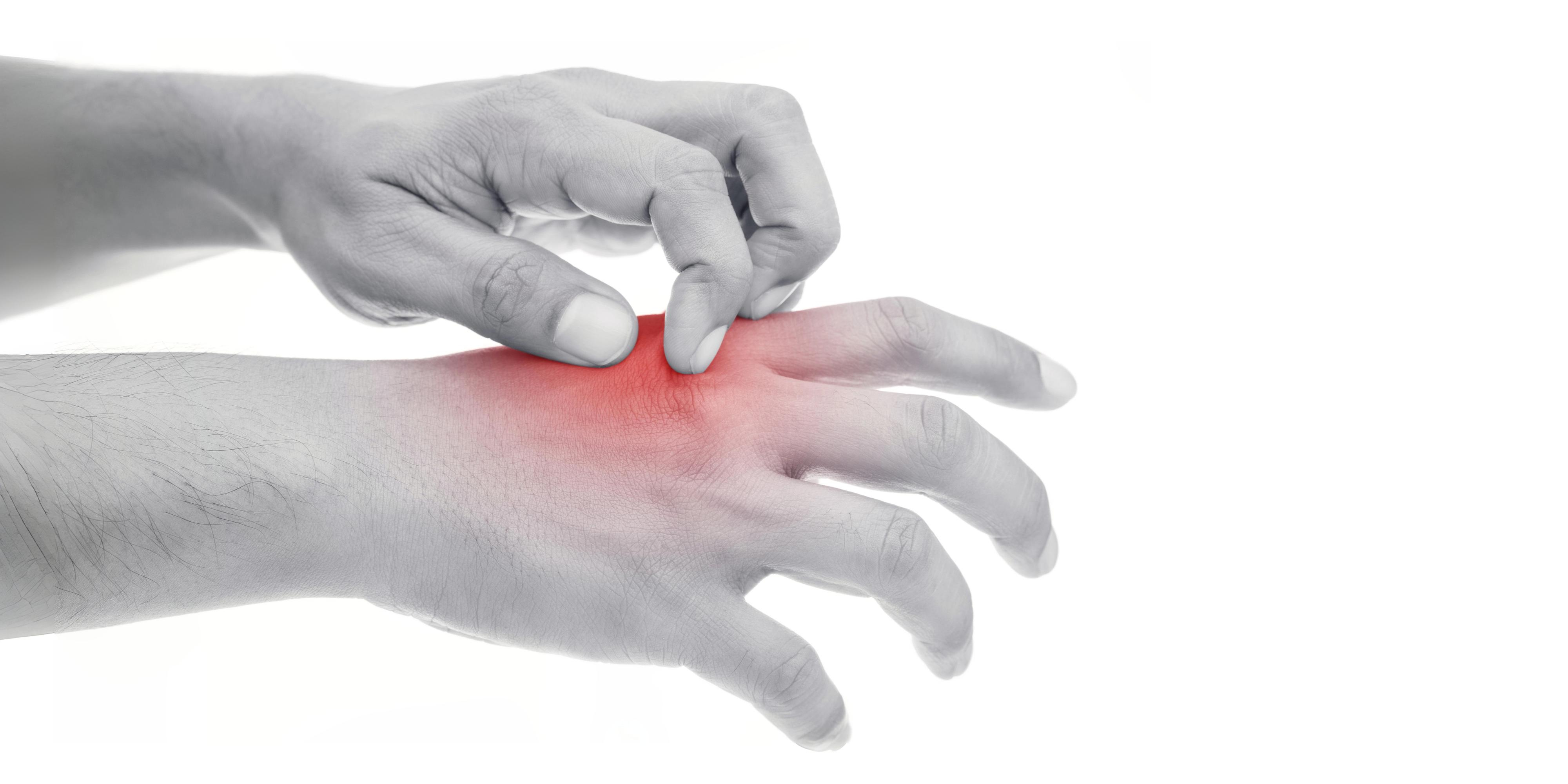 Mit Bioprinting gegen Psoriasis und Neurodermitis