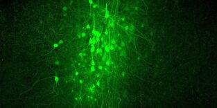 Fluoreszenzmikroskopische Aufnahme von Nervenzellen und ihren Fortsätzen. Die grün markierten Neuronen bilden ein dichtes Netzwerk aus Zellkörpern und Nervenfasern vor dunklem Hintergrund.