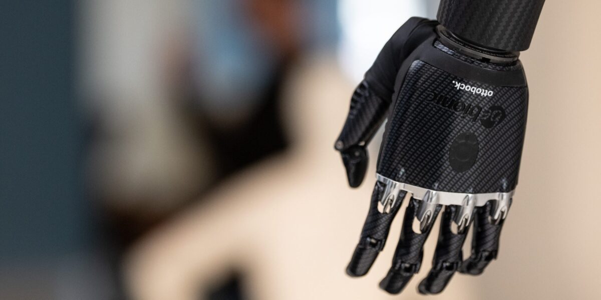 Myoelektrisch gesteuerte Handprothese von Ottobock