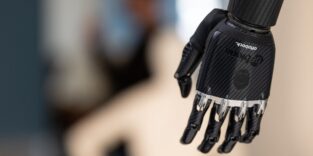Myoelektrisch gesteuerte Handprothese von Ottobock