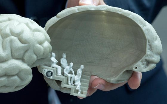 Mit diesem Hirnatlas lassen sich schwere Krankheiten besser erforschen