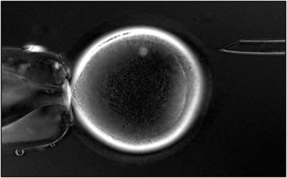 Aus Hautzellen menschlichen Embryo geklont
