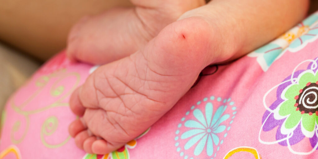 Foto eines Babyfußes mit einem winzigen Schnitt an der Ferse.