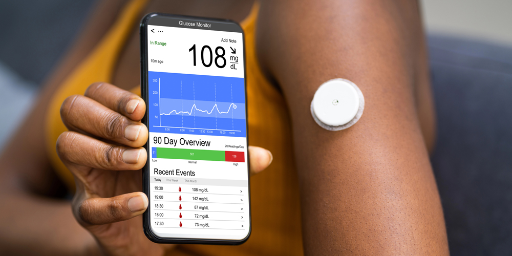 Ein Arm mit einem dauerhaften Blutzucker-Messsystem und einem Smartphone im Vordergrund.