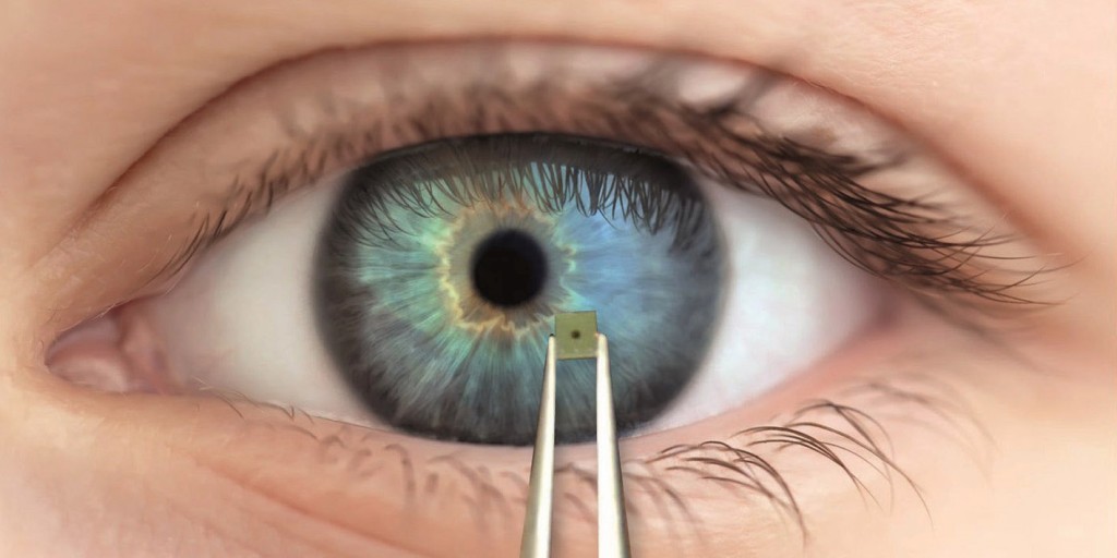 Ein Mikrochip im Auge