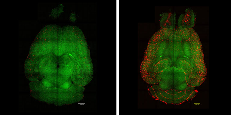 Nanopartikel lassen Alzheimer verschwinden – bei Mäusen