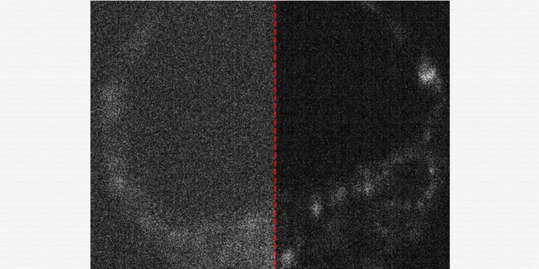 Quantenkameras erlauben scharfen Blick auf den Beginn des Lebens